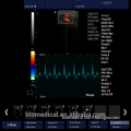 Color Doppler Ultrasonic System & Hospital Used Color Portable Ultrasound Scanner Equipment